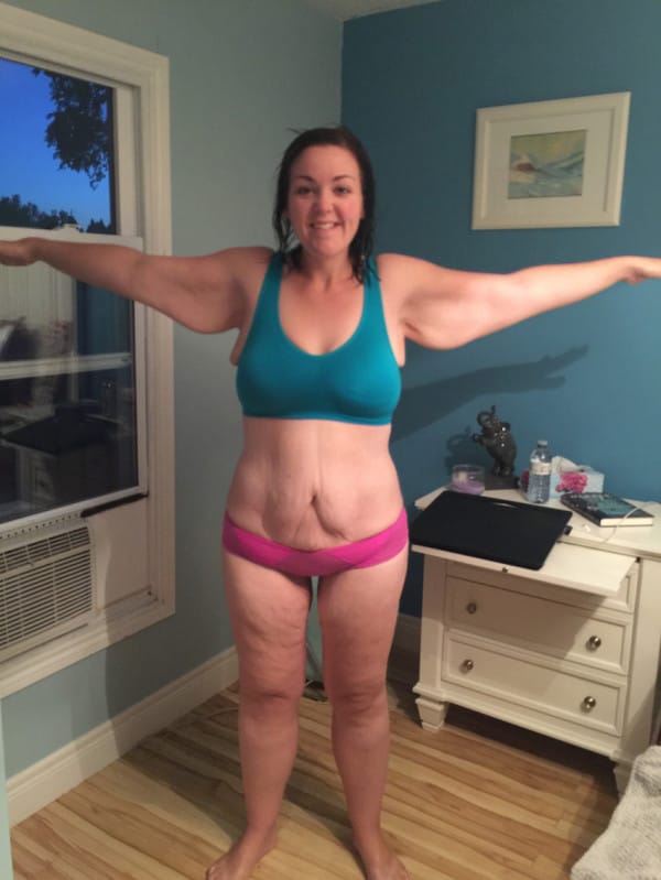 She Loses 210 Pounds And Just Wore A Bikini For The First Time In Years 