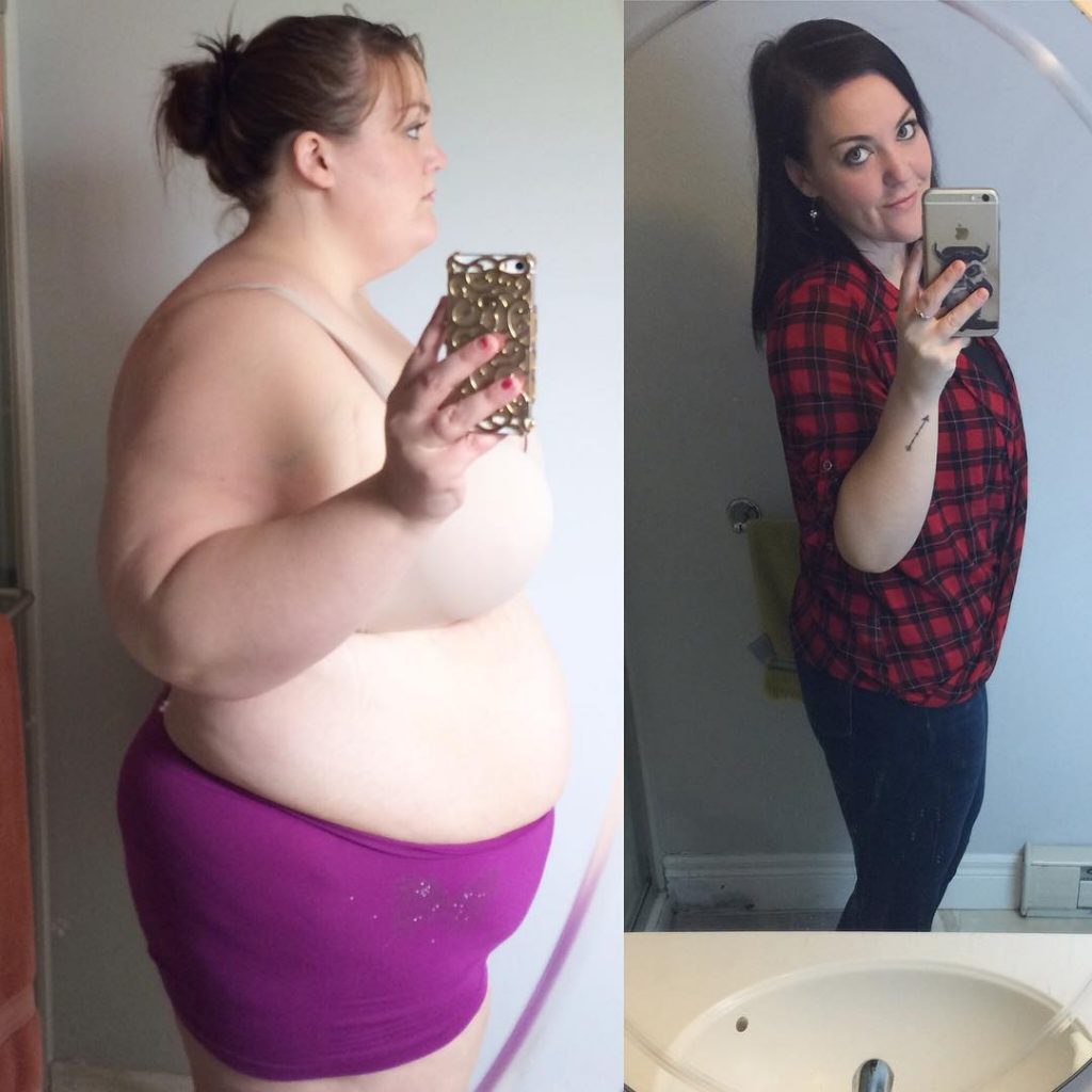 She Loses 210 Pounds And Just Wore A Bikini For The First Time In Years.